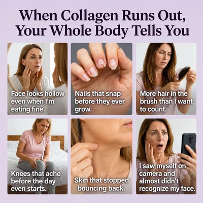 Multi Collagen Complex 8:1 - Complete Beauty Collagen