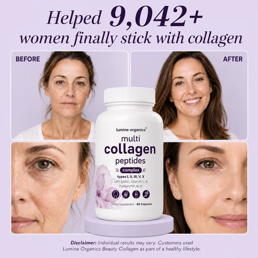 Multi Collagen Complex 8:1 - Complete Beauty Collagen